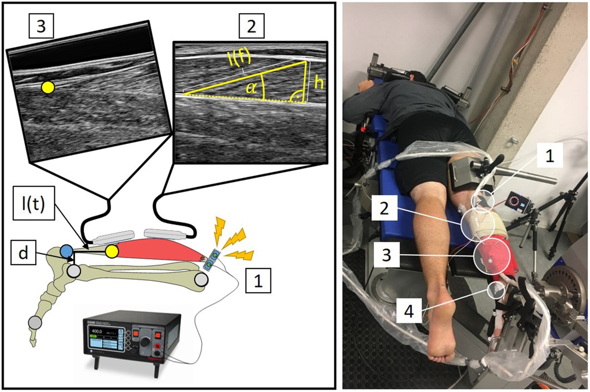 Decoupling of muscle-tendon unit and fascicle velocity contributes to the in vivo stretch-shortening cycle effect in the male human triceps surae muscle