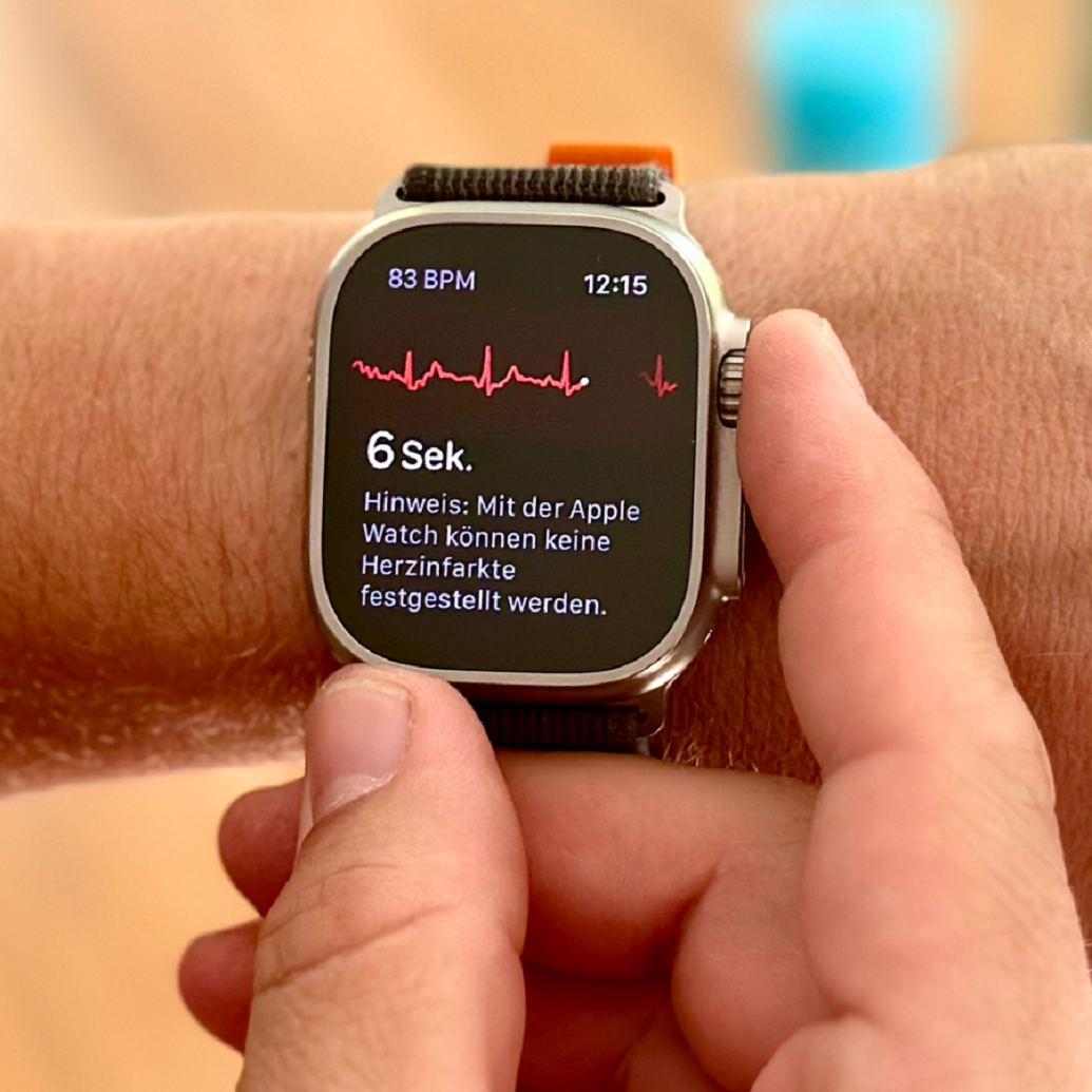 Diagnostic Accuracy of Single-Lead Electrocardiograms Using the Kardia Mobile App and the Apple Watch 4: Validation Study