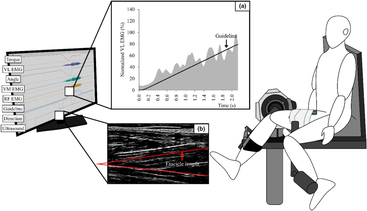 Modulation of stretch activation influences the stretch-shortening cycle effect in in vivo human knee extensors