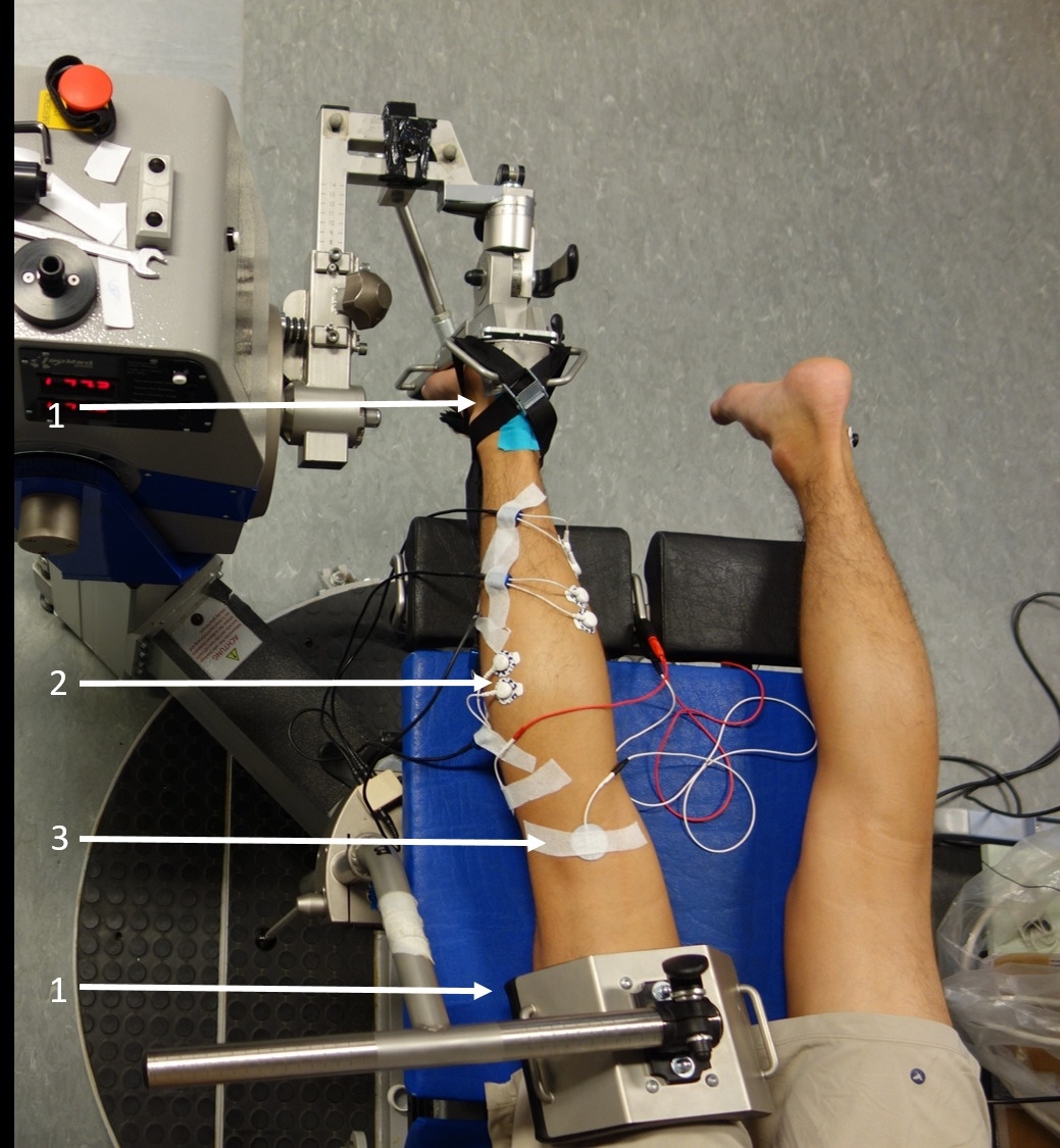 Residual force enhancement in humans: Is there a true non-responder?