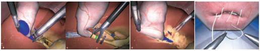 surgery_2.jpg