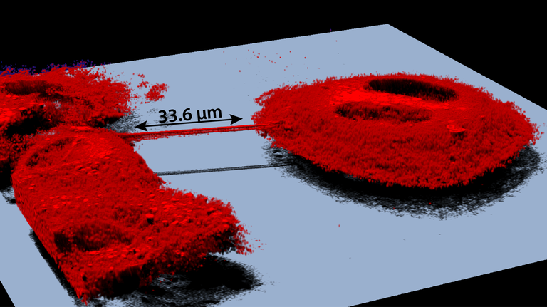 Nanotubes between glioblastoma cells