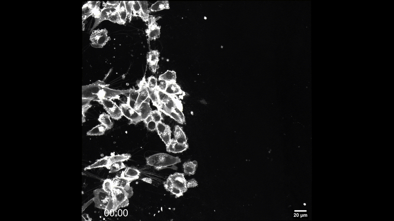 Fluorescence microscopy of migration