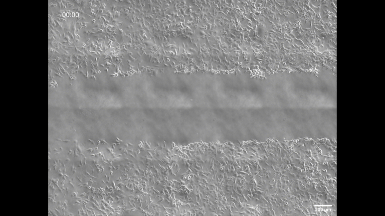 Phase contrast microscopy of migration