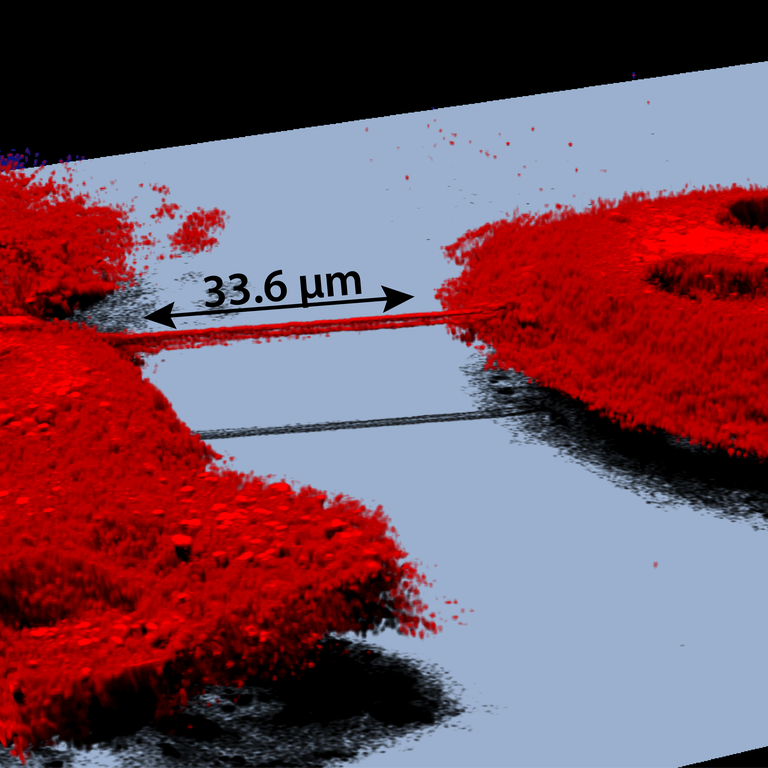 Nanotubes zwischen Glioblastomzellen